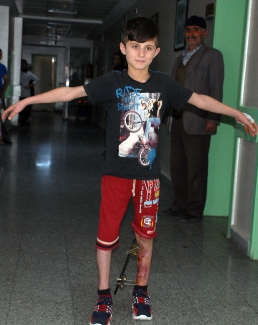 10 yaşındaki çocuğun bacağı kesilmekten kurtarıldı