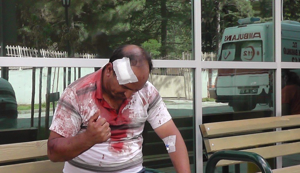 Konya'da kavga: Başından bıçaklandı