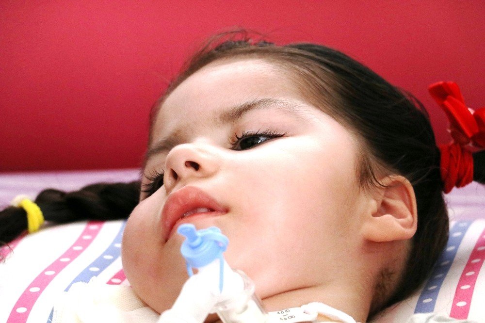 SMA hastası Arife 4 dozluk ilaç desteğiyle yaşama tutundu