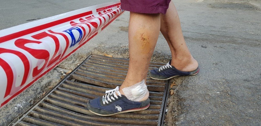 Ayağı demir mazgala sıkışan vatandaş yaralandı
