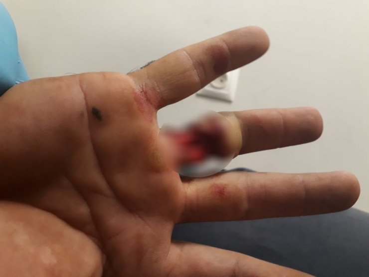 Elini iş makinesine kaptıran işçinin yüzüğü parmağına saplandı