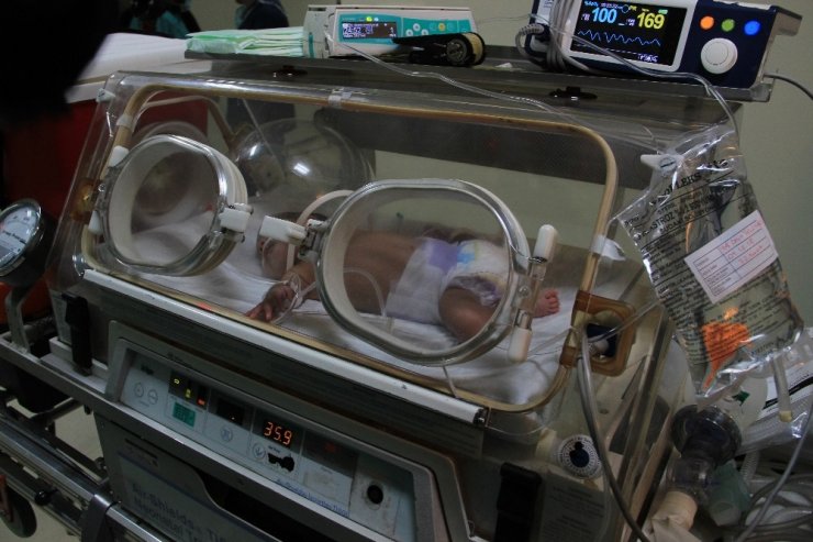800 gram doğan Ömer Pusat bebek 3 santimetrelik kesi ile hayata tutundu