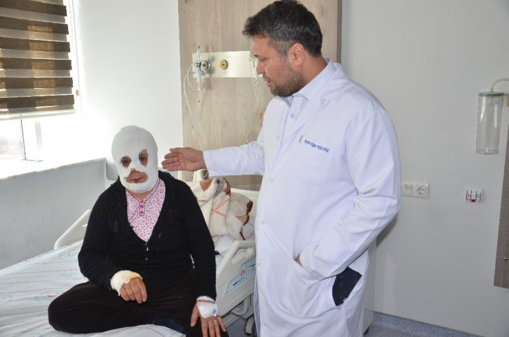 Elbistan Devlet Hastanesi Yanık Odası, 443 hastaya hizmet verdi