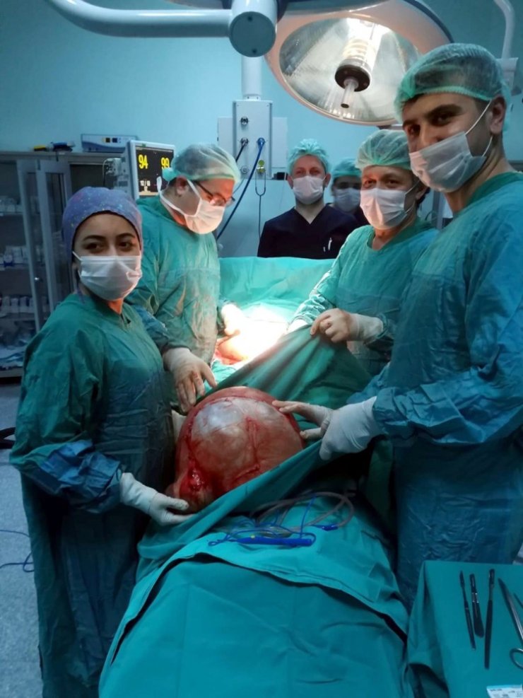 Ameliyat olmaktan korkan kadının kadının karnından 13 kiloluk kitle çıktı