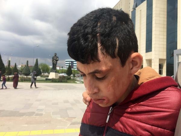 Komşusu ve çocuklarını kezzapla yaktığı iddia edilmişti...Konya'daki flaş olayın sanığı serbest bırakıldı!