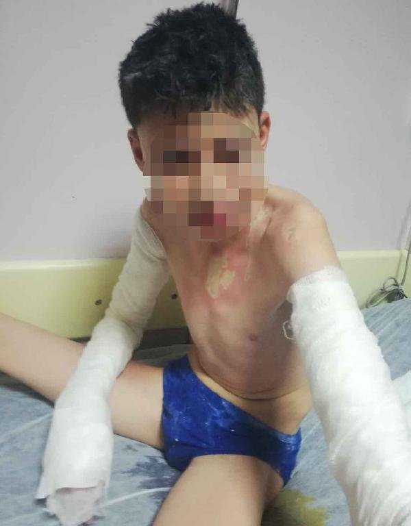 Komşusu ve çocuklarını kezzapla yaktığı iddia edilmişti...Konya'daki flaş olayın sanığı serbest bırakıldı!