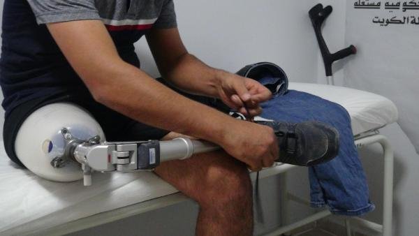 Savaşta el ve bacaklarını kaybeden 590 Suriyeliye protez takıldı
