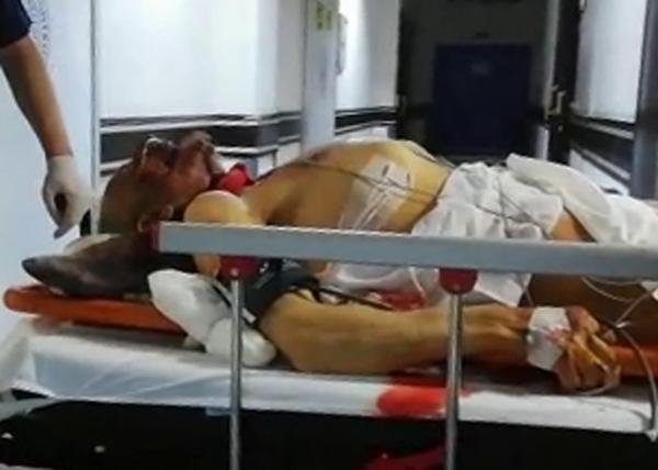 Erzurum'da ayı saldırısı: 1 ölü, 2 yaralı 