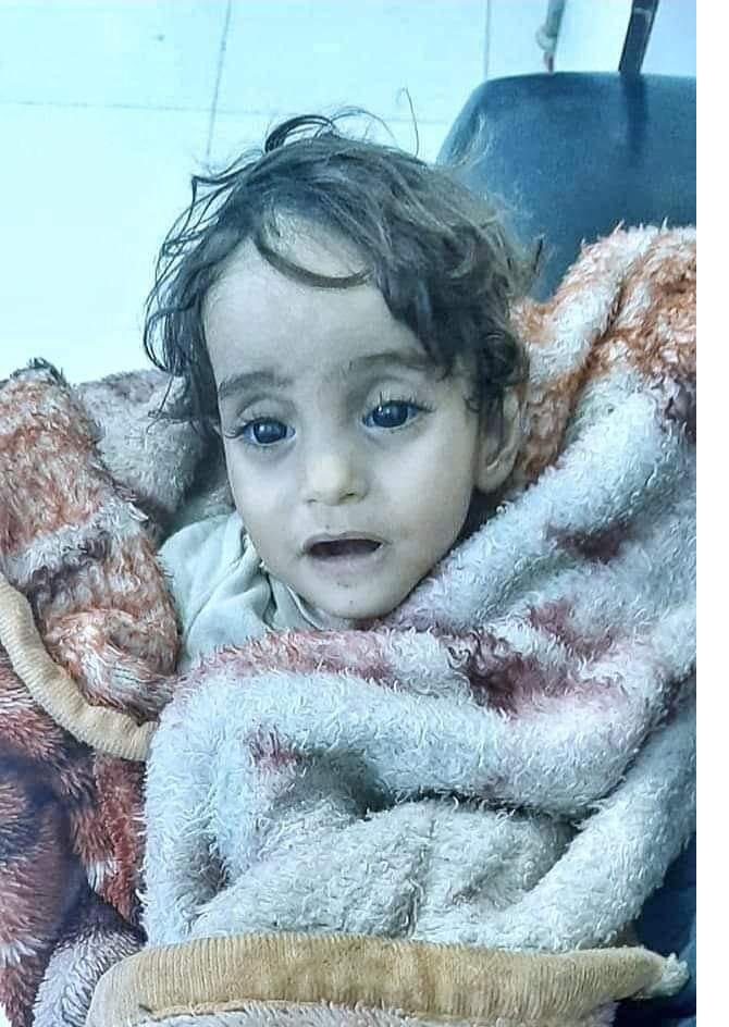 Esed rejiminin evsiz bıraktığı İman bebek soğuktan öldü Esed rejiminin evsiz bıraktığı İman bebek soğuktan öldü